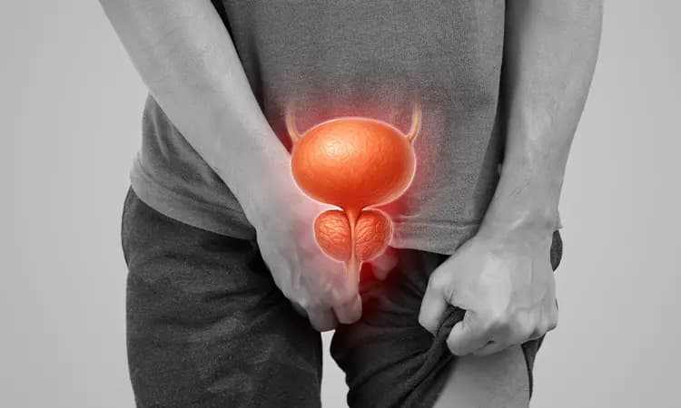 Advanced Prostate Cancer Treatment Guide: Immunotherapy, Hormone Therapy, Radiation, and Clinical Trials